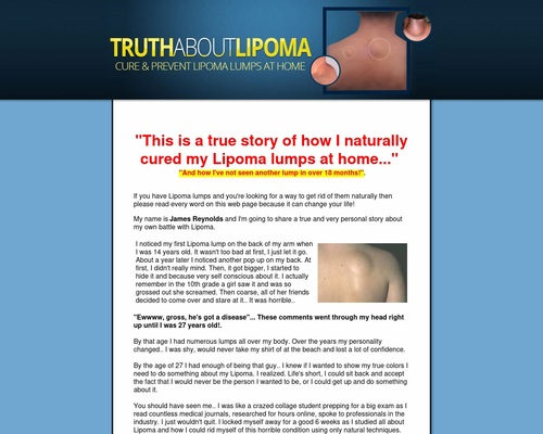 Truth About Lipoma by James Reynolds